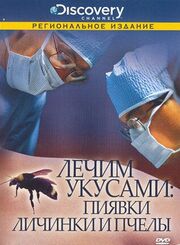 Discovery: Лечим укусами. Пиявки, личинки и пчелы - лучший фильм в фильмографии Peter Getzels