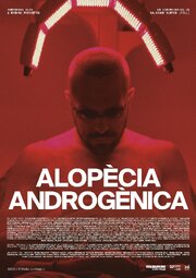 Alopècia androgènica - лучший фильм в фильмографии Toni Vidal